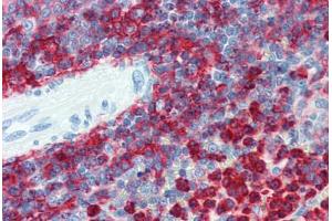Spleen, Human: Formalin-Fixed, Paraffin-Embedded (FFPE) (Integrin beta 2 抗体  (AA 534-546))