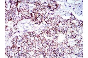 Immunohistochemistry (IHC) image for anti-Activated Leukocyte Cell Adhesion Molecule (ALCAM) (AA 48-216) antibody (ABIN1846221) (CD166 抗体  (AA 48-216))