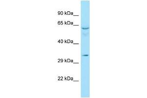 WB Suggested Anti-RAD51D Antibody Titration: 1. (RAD51D 抗体  (C-Term))