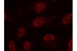 Immunofluorescence staining of methanol-fixed HeLa cells using Phospho-MAPKAPK2-T334 antibody (ABIN2988148). (MAPKAP Kinase 2 抗体  (pThr334))