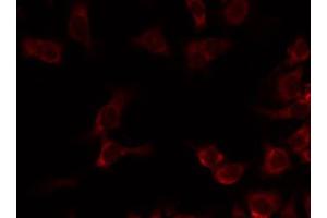 ABIN6274734 staining Hela by IF/ICC. (MRPL20 抗体  (C-Term))