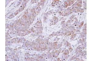 IHC-P Image Immunohistochemical analysis of paraffin-embedded SG xenograft , using BHMT, antibody at 1:100 dilution. (BHMT 抗体)