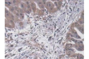 Immunohistochemistry (IHC) image for anti-Synaptotagmin I (SYT1) (AA 136-422) antibody (ABIN7444403)