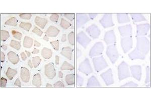 Immunohistochemistry analysis of paraffin-embedded human skeletal muscle tissue, using Clock Antibody. (CLOCK 抗体  (AA 241-290))