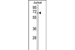 Western blot analysis of RBM14 Antibody (Center) (ABIN650783 and ABIN2839556) in Jurkat cell line lysates (35 μg/lane). (RBM14 抗体  (AA 193-223))