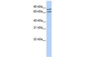 Image no. 1 for anti-Transcription Factor E3 (TFE3) (AA 324-373) antibody (ABIN6742380) (TFE3 抗体  (AA 324-373))