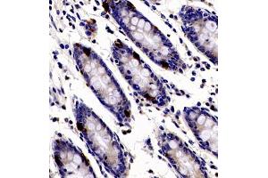 Immunohistochemistry of paraffin embedded human colon using ANKK1 (ABIN7073056) at dilution of 1:200 (400x lens)