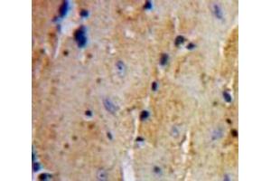 IHC-P analysis of Heart tissue, with DAB staining. (UCHL3 抗体  (C-Term))