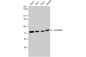 WB Image ZC3H12A antibody detects ZC3H12A protein by western blot analysis.