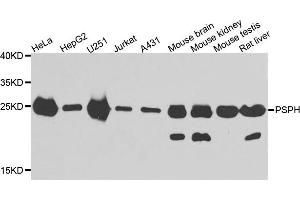 Western blot analysis of extracts of various cell lines, using PSPH antibody. (PSPH 抗体)