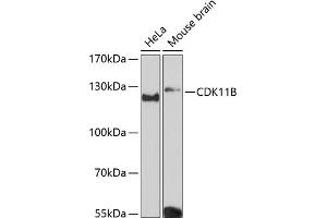 Western blot analysis of extracts of various cell lines, using CDK11B Antibody (ABIN6130092, ABIN6138305, ABIN6138306 and ABIN6216598) at 1:3000 dilution. (CDK11 抗体  (AA 1-130))