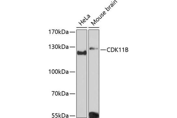 CDK11 抗体  (AA 1-130)