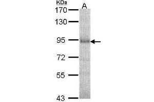 WB Image Sample (30 ug of whole cell lysate) A: A549 7. (DPP8 抗体)