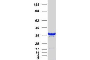 Western Blotting (WB) image for GIPC PDZ Domain Containing Family, Member 1 (GIPC1) (Transcript Variant 1) protein (Myc-DYKDDDDK Tag) (ABIN2721886)