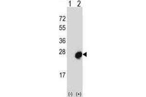 Western blot analysis of Mid1-interacting protein 1 (arrow) using rabbit polyclonal MID1IP1 Antibody  (N-term). (m1ip1 抗体  (N-Term))