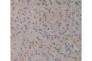 Immunohistochemistry (IHC) image for anti-Killer Cell Lectin-Like Receptor Subfamily B, Member 1 (KLRB1) (AA 73-188) antibody (ABIN7439978)