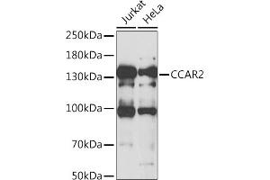 Western blot analysis of extracts of various cell lines, using CC antibody (ABIN6133528, ABIN6138034, ABIN6138035 and ABIN6222941) at 1:1000 dilution. (CCAR2 抗体  (AA 654-923))