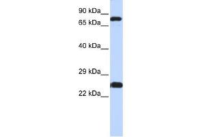 WB Suggested Anti-ZNF799 Antibody Titration:  0. (ZNF799 抗体  (N-Term))