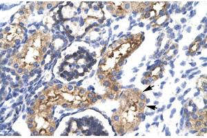 Human kidney; EHF antibody - N-terminal region in Human kidney cells using Immunohistochemistry (EHF 抗体  (N-Term))