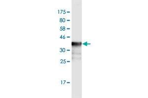 Western Blot detection against Immunogen (36. (PPM1F 抗体  (AA 1-100))