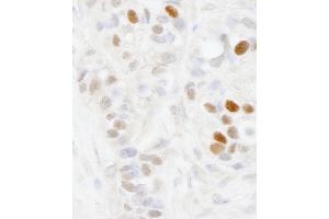 Immunohistochemistry (IHC) image for anti-Melanoma Antigen Family D, 2 (MAGED2) (AA 50-100) antibody (ABIN7448635) (MAGED2 抗体  (AA 50-100))