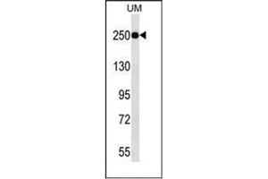 Western blot analysis of JARID1A Antibody (C-term) in UM cell line lysates (35ug/lane). (KDM5A 抗体  (C-Term))