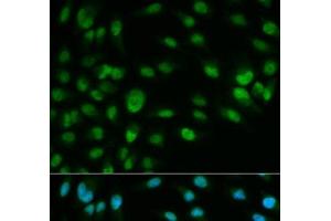 Immunofluorescence analysis of HeLa cells using MCM7 Polyclonal Antibody (MCM7 抗体)