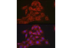 Immunofluorescence analysis of C6 cells using Mineralocorticoid receptor (NR3C2) Rabbit pAb (ABIN1681109, ABIN3017672, ABIN3017673 and ABIN6220207) at dilution of 1:100 (40x lens).