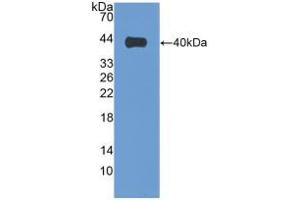 Western blot analysis of recombinant Human VIL1. (Villin 1 抗体  (AA 1-320))