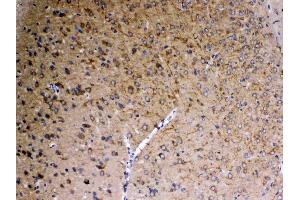 IHC analysis of SAP102 using anti-SAP102 antibody . (DLG3 抗体  (AA 749-817))