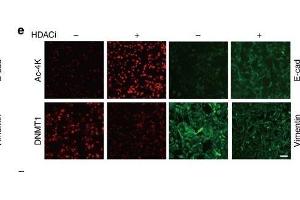 Immunofluorescence (Cultured Cells) (IF (cc)) image for anti-DNA (Cytosine-5)-Methyltransferase 1 (DNMT1) (AA 1-270) antibody (ABIN6139745)