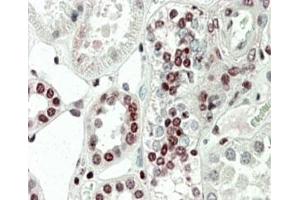 IHC staining of FFPE human kidney with PRAK antibody at 5ug/ml. (MAPKAP Kinase 5 抗体)