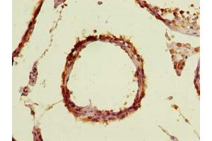 Immunohistochemistry of paraffin-embedded human testis tissue using ABIN7171606 at dilution of 1:100 (TBC1D19 抗体  (AA 1-300))