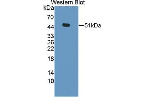 Western blot analysis of the recombinant protein. (CPA3 抗体  (AA 16-417))