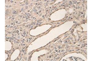 Immunohistochemical staining of formalin-fixed paraffin-embedded rat kidney tissue showing cytoplasmic and nuclear staining with AHR polyclonal antibody  at 1 : 200 dilution. (Aryl Hydrocarbon Receptor 抗体  (N-Term))