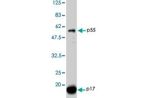 Detection of HIV-1 p17 and its p55 precursor proteins by Western blotting using the HIV-1 Gag p17 polyclonal antibody  . (HIV-1 p17 抗体)