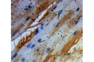 Used in DAB staining on fromalin fixed paraffin-embedded Heart tissue (BDNF 抗体  (AA 129-247))