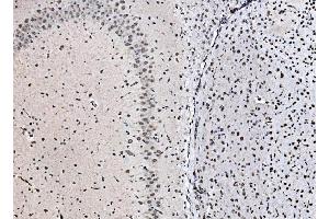 IHC analysis of DBC-1/CCAR2 using anti-DBC-1/CCAR2 antibody (ABIN7602235). (CCAR2 抗体  (AA 65-917))