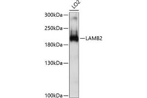 Western blot analysis of extracts of LO2 cells, using L antibody (ABIN6132095, ABIN6143070, ABIN6143071 and ABIN6214860) at 1:1000 dilution. (LAMB2 抗体  (AA 1579-1798))