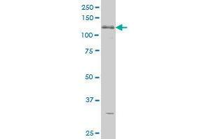 Image no. 3 for anti-ABL2 (ABL2) (AA 743-842) antibody (ABIN465946) (ABL2 抗体  (AA 743-842))