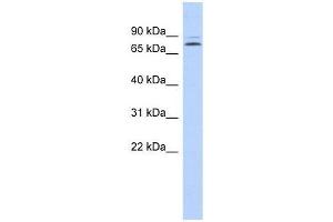 KLHL14 antibody used at 0. (KLHL14 抗体  (N-Term))