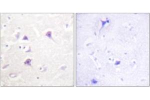 Immunohistochemistry analysis of paraffin-embedded human brain tissue, using HER4 (Ab-1284) Antibody. (ERBB4 抗体  (AA 1250-1299))