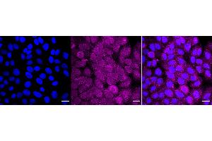 Immunocytochemical staining of HepG2 cells with drosha ribonuclease III antibody (ABIN7798389), 1:1,000).