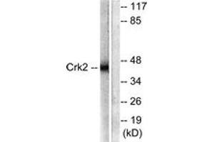 Western blot analysis of extracts from COS7 cells, using CrkII (Ab-221) Antibody. (Crk 抗体  (AA 187-236))