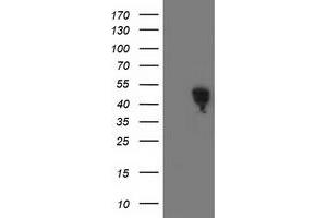 Western Blotting (WB) image for anti-Spermine Synthase, SMS (SMS) antibody (ABIN1501091) (SMS 抗体)