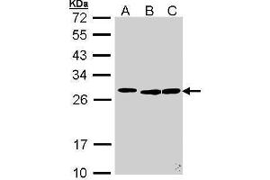 WB Image Sample (30 ug of whole cell lysate) A: 293T B: Molt-4 , C: Raji 12% SDS PAGE antibody diluted at 1:500 (SFRS9 抗体  (Center))