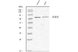Western blot analysis of 5-HT2C Receptor/HTR2C using anti-5-HT2C Receptor/HTR2C antibody (ABIN7601526).