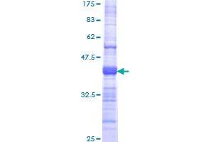 TMPRSS15 Protein (AA 361-470) (GST tag)