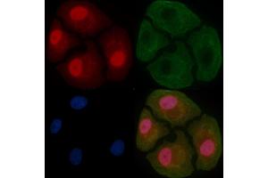 GATAD2A Mouse Monoclonal Antibody staining Hela cells by IF/ICC. (GATAD2A 抗体)