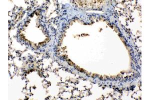 Immunohistochemistry (IHC) image for anti-Periplakin (PPL) (AA 1664-1701), (C-Term) antibody (ABIN5518787)